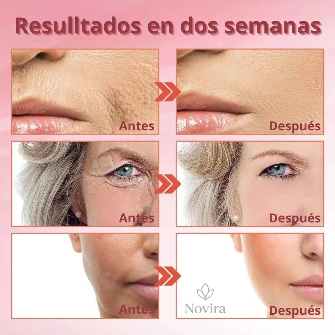 Infibella™ Crema Anti Edad hidratante